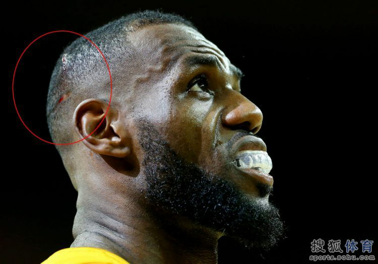 包含转折点北京国安强势反弹克里夫兰骑士赛前完成体检，连对手都承认：塔图姆在老鹰比赛中赛事规则更新的词条